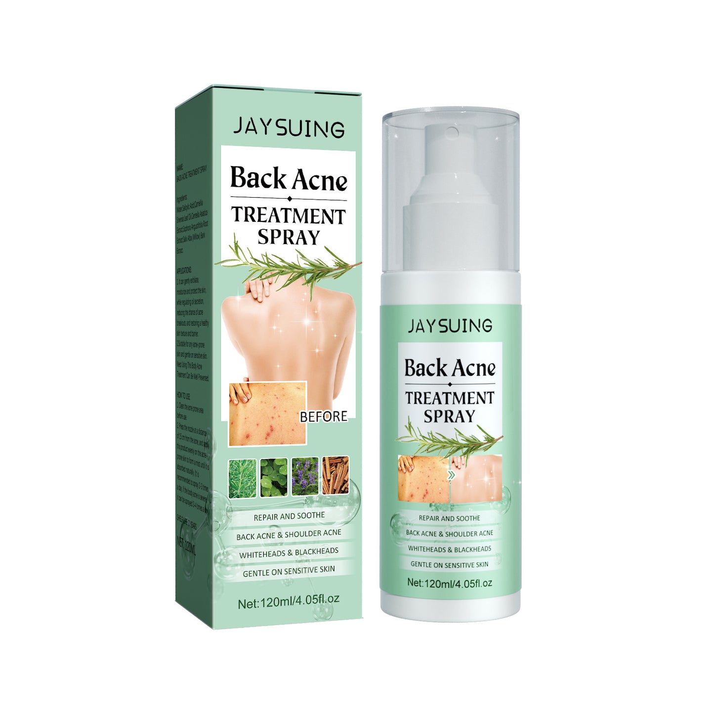 πΉ Back Anti-Acne β π₯ Pimples β’ π§ Hydrates β’ π‘οΈ Purifies β’ β¨ Repairs π₯ Fades Marks