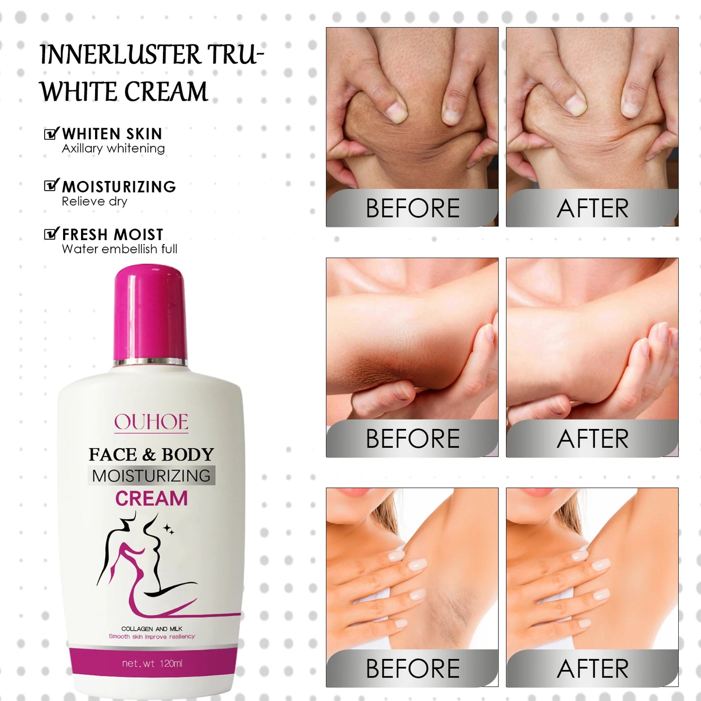 Ouhoe Brightening Skin Lotion πΈβ¨ | Nourishing & Repair π€ | Dullness Repair πΏ | Hydrating π§ | Whitening Skin Tone π | Body Care Lotion for Arm, Leg & Knee π¦΅π