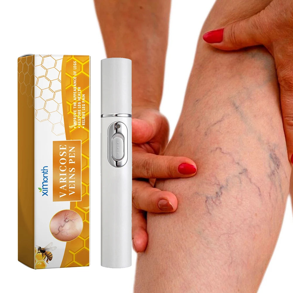 π‘β¨ LED Therapy Pen β Relief for Varicose Veins & Improved Circulation β¨π‘