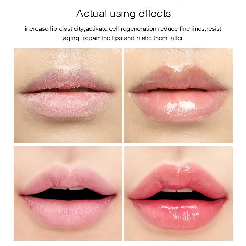 πβ¨ 17ml Instant Volumising Lip Plumper Serum β Sexy, Plump & Hydrated Lips πΏπ
