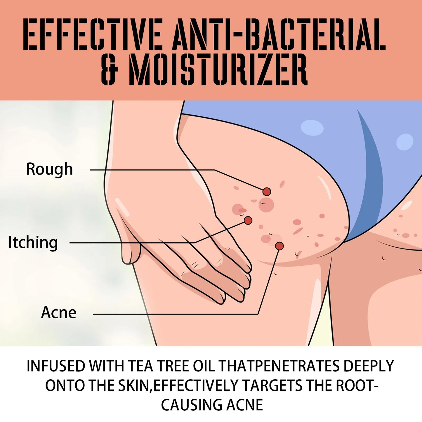 πβ¨ West&Month Butt Acne Treatment Cream β Smooth, Clear & Hydrated Skin ππ