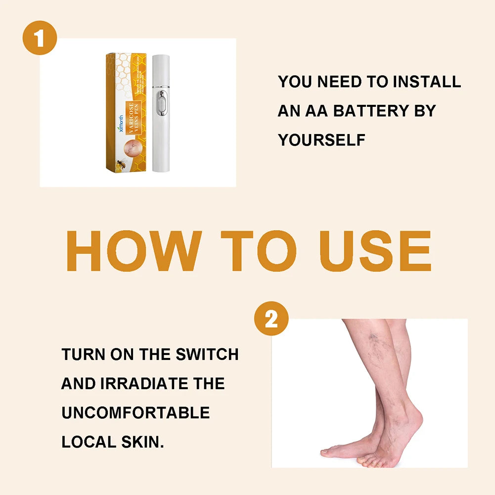 π‘β¨ LED Therapy Pen β Relief for Varicose Veins & Improved Circulation β¨π‘