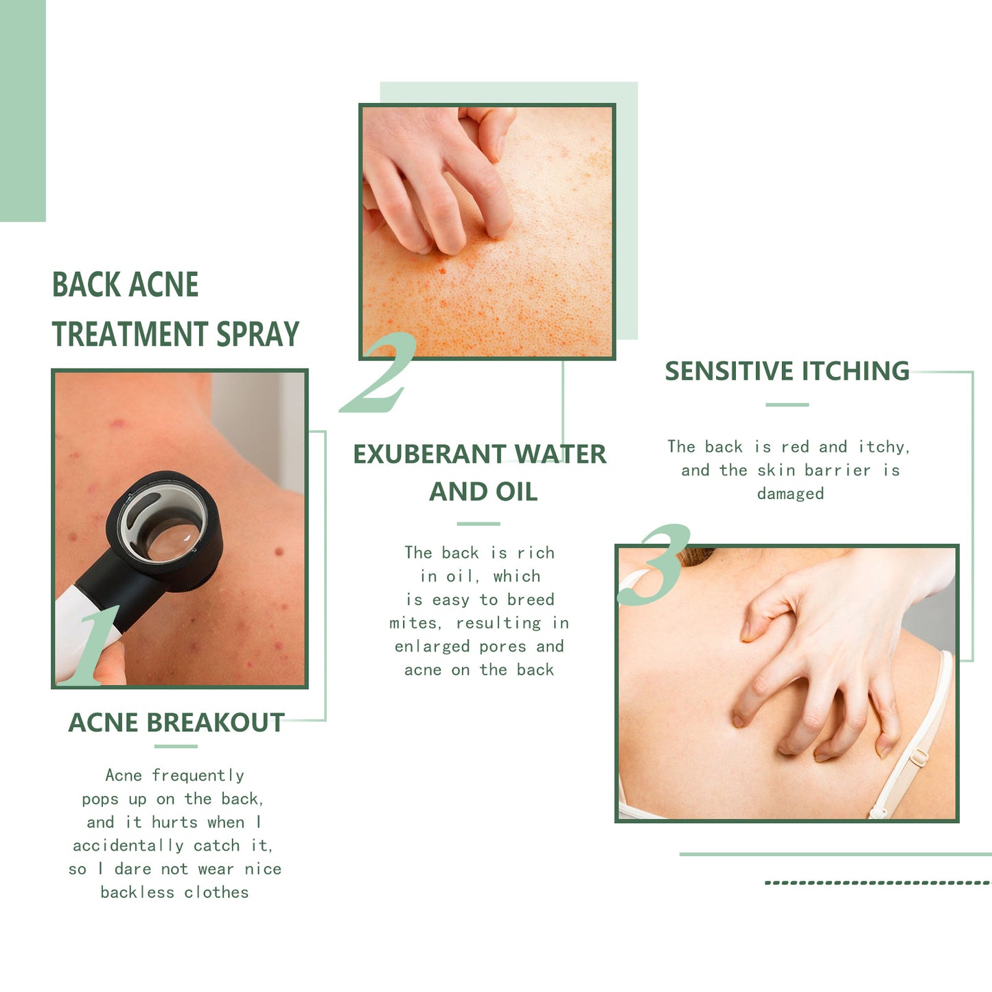 πΉ Back Anti-Acne β π₯ Pimples β’ π§ Hydrates β’ π‘οΈ Purifies β’ β¨ Repairs π₯ Fades Marks