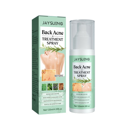 🔹 Back Anti-Acne – 🔥 Pimples • 💧 Hydrates • 🛡️ Purifies • ✨ Repairs 💥 Fades Marks