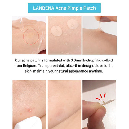 🌿 Targeted Care Stickers – Reduced Blemishes & Marks