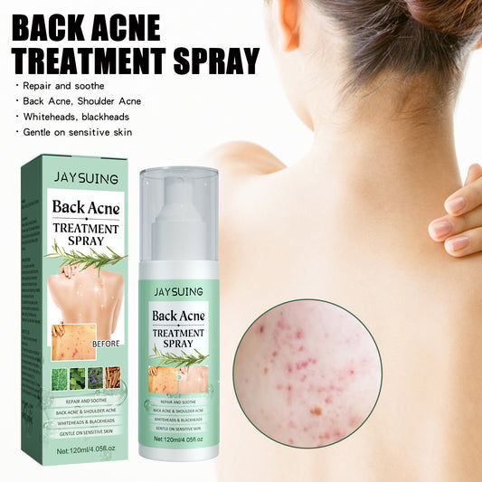 🔹 Back Anti-Acne – 🔥 Pimples • 💧 Hydrates • 🛡️ Purifies • ✨ Repairs 💥 Fades Marks