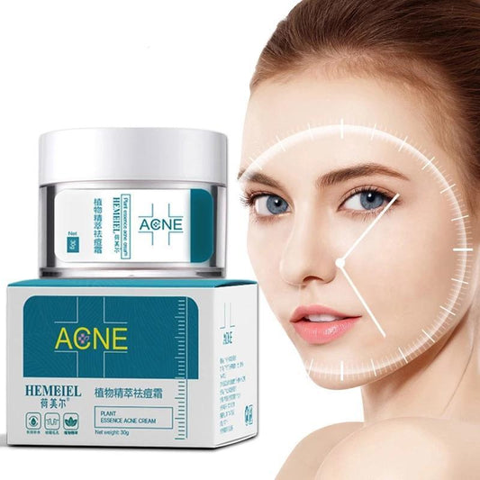 🔹 Anti-Acne Cream – 🎯 Targeted Care – 🧴 Blemish-Prone Skin