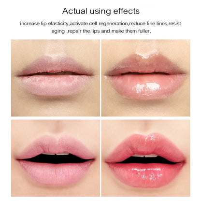 💋✨ 17ml Instant Volumising Lip Plumper Serum – Sexy, Plump & Hydrated Lips 🌿💖