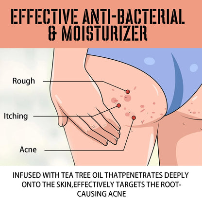 🍑✨ West&Month Butt Acne Treatment Cream – Smooth, Clear & Hydrated Skin 💖🛁