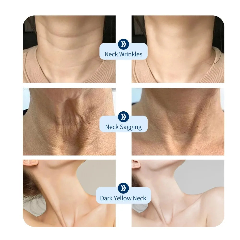 Neck LED Photon Anti-Wrinkle Skin Tightening Device