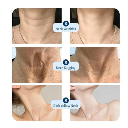 Neck LED Photon Anti-Wrinkle Skin Tightening Device