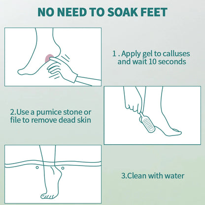 🦶✨ Nailpop Professional Callus Remover Kit – Extra Strength Gel & Foot File ✨🦶